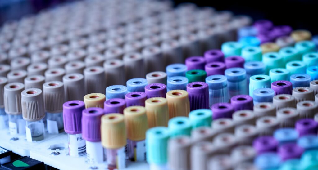 Test tubes in a lab tray